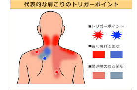 首の痛み　整骨院　鯖江